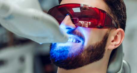 Laser teeth whitening is a little costly